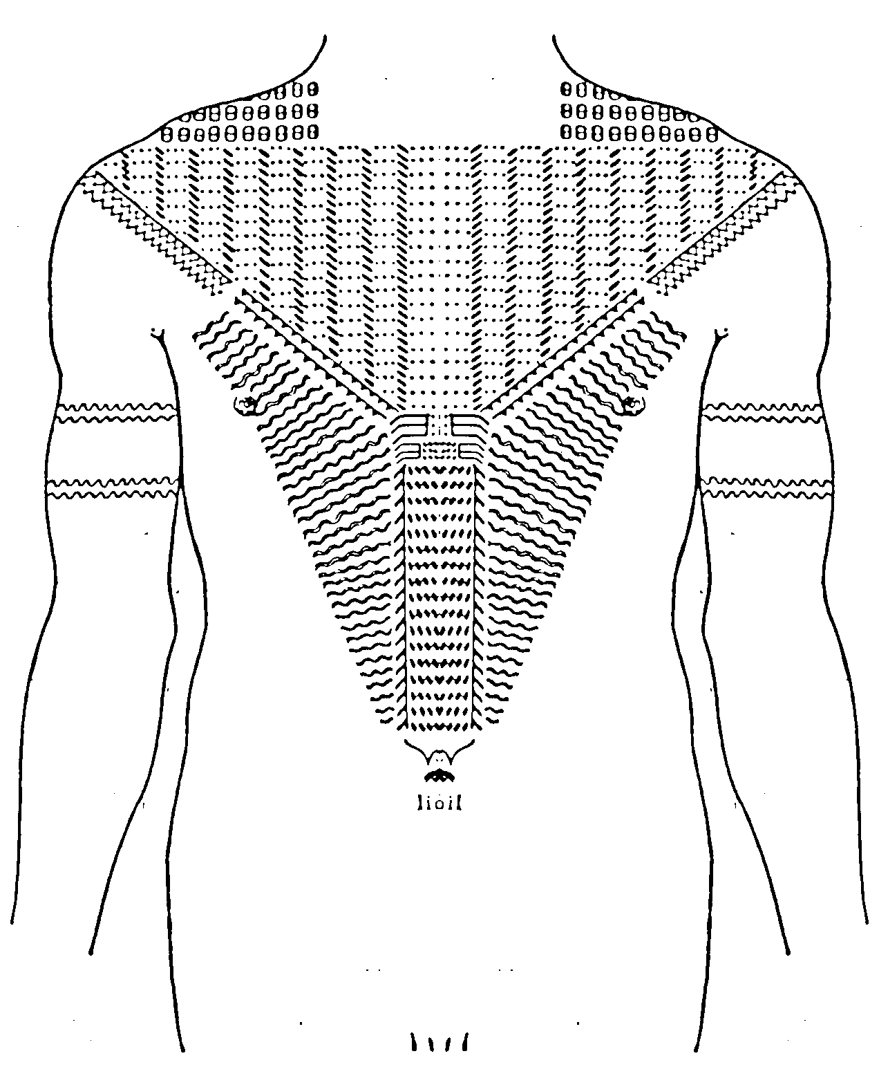 Figure 26 Chest tattoo of a