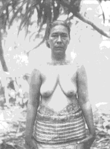 Tattoo On Deltoid. Chest tattoo of Lijolok , a woman of chiefly rank on Arno Atoll taken in